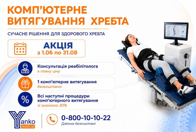 Комп’ютерне витягування хребта